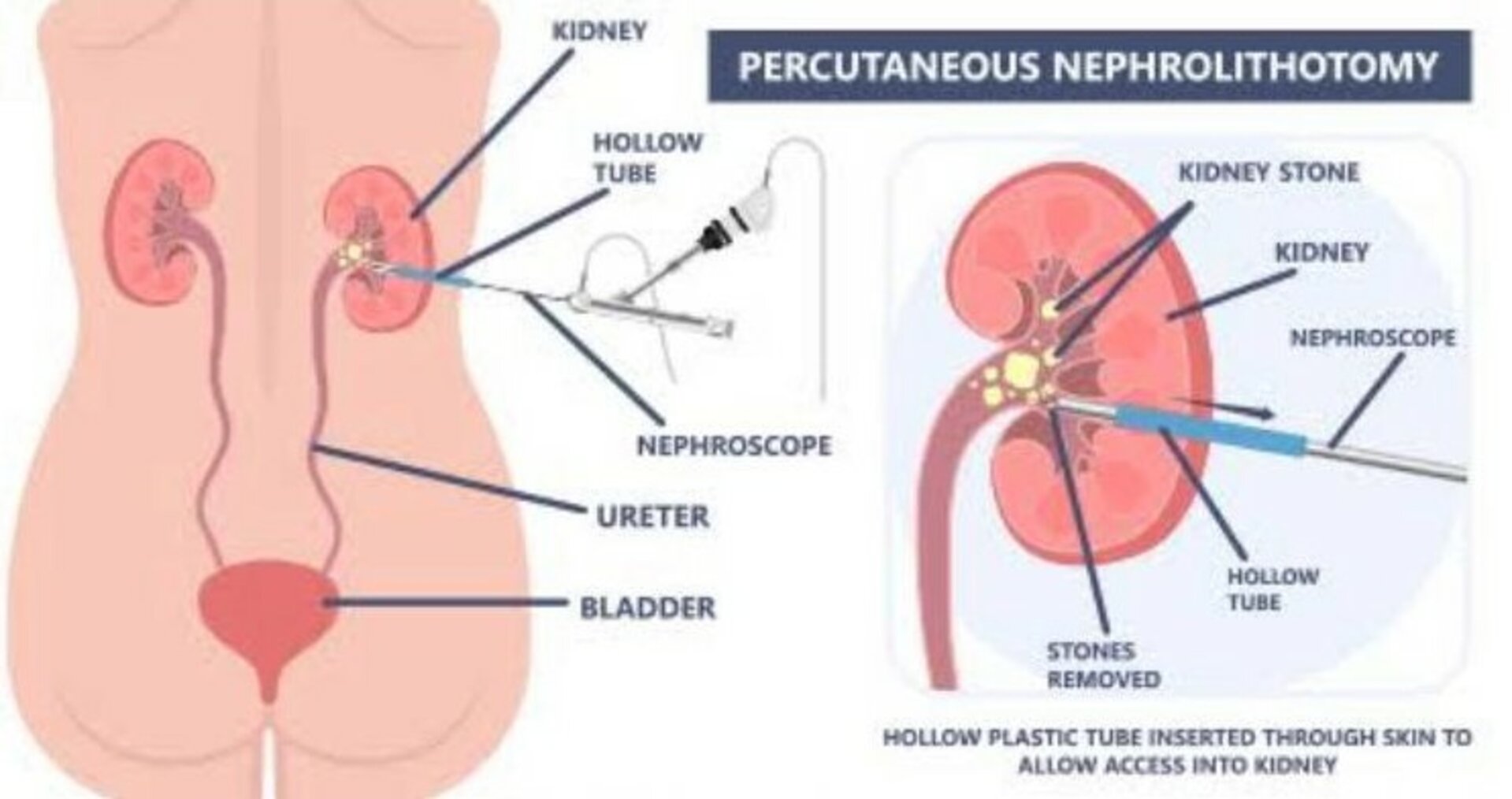 Urozoone Holistic Kidney Care Clinic|Viman Nagar,Pune