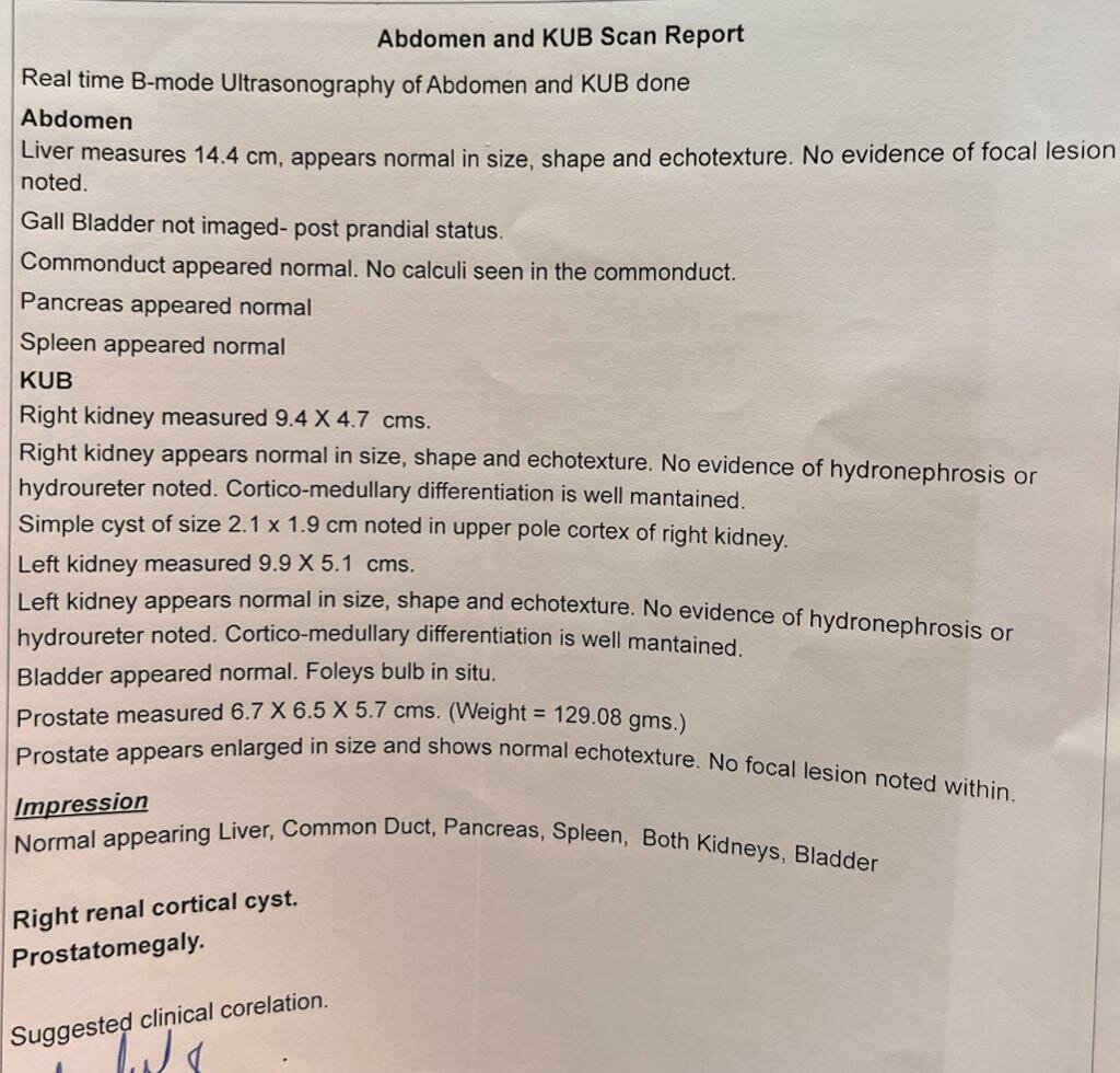 Urine Retention Post Angioplasty treated by Thulium laser Enucleation of Prostate | Dr. Bhoopat Bhati|Urozoone Holistic Kidney Care Clinic|Viman Nagar,Pune