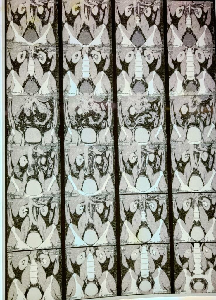 Urozoone Holistic Kidney Care Clinic|Viman Nagar,Pune