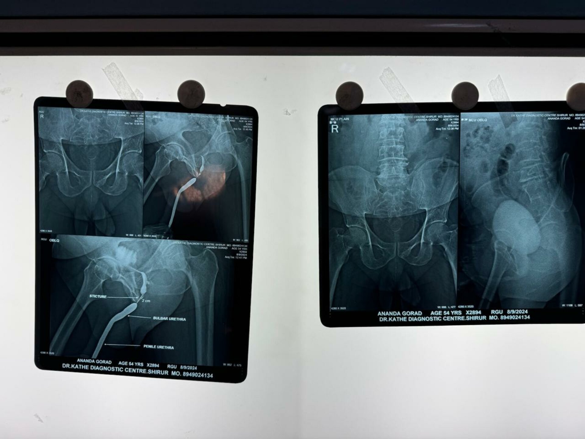 Urozoone Holistic Kidney Care Clinic|Viman Nagar,Pune